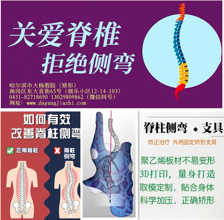 關(guān)注青少年脊柱側(cè)彎