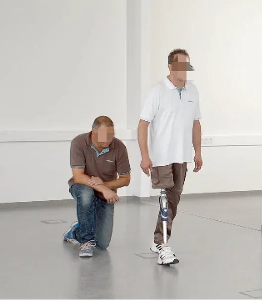 假肢---重新學習走路