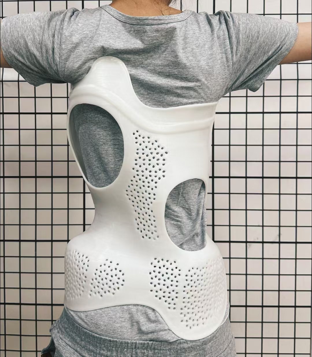 脊柱側(cè)彎支具穿戴3個月要及時復(fù)查