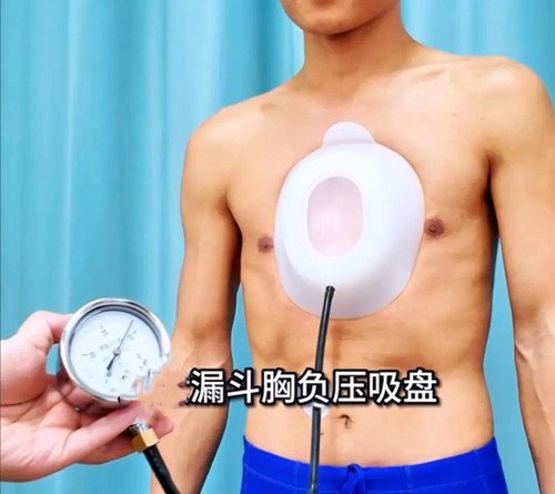 漏斗胸怎么矯正？