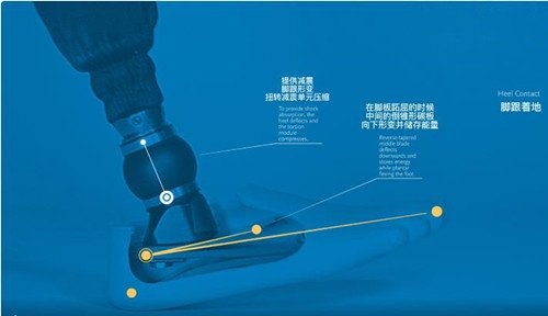 低外型碳纖徦腳飛毛腿